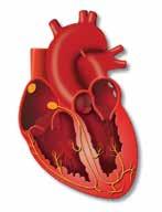 Minha insuficiência cardíaca A insuficiência cardíaca é uma condição onde o coração encontrase incapaz de bombear sangue para o corpo tão bem quanto deveria.
