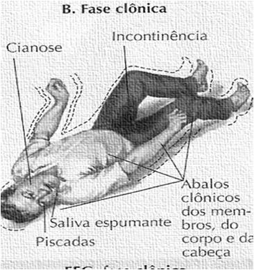 Grande Mal Depressão pós crise Principais Barbitúricos: