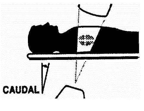 direção à cabeça do paciente. Figura VII: Incidência craneal (Cr) 3.1.