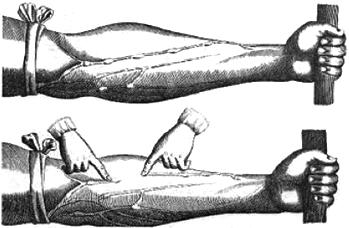 No experimento ilustrado, Harvey, após aplicar um torniquete (A) no braço de um voluntário e esperar alguns vasos incharem, pressionava-os em um ponto (H).
