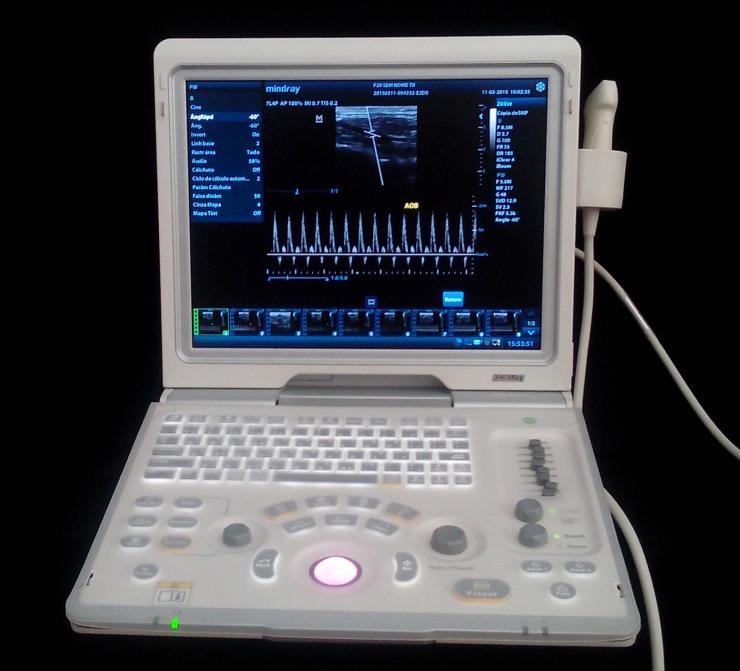 85 4.7 Parâmetros avaliados no experimento Para a coleta dos parâmetros hemodinâmicos foi utilizado um aparelho de ultrassonografia da Marca Mindray, modelo Z6 Vet, com