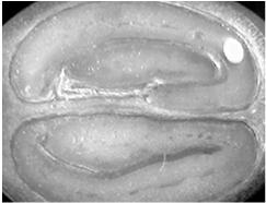 Enfraquecimento de paredes celulares: endo-β-mananase Aspectos do crescimento do eixo