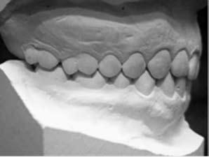 9. Considerando que os valores normativos dentários e cefalométricos, propostos pelos diversos autores, estão baseados em pesquisas realizadas com amostras obtidas a partir de grupos raciais e