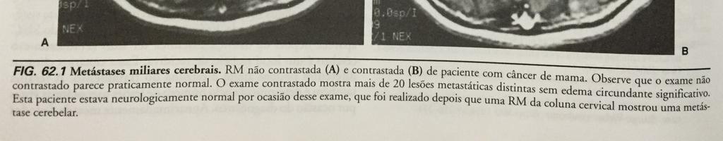 neurologia. 11.ed.