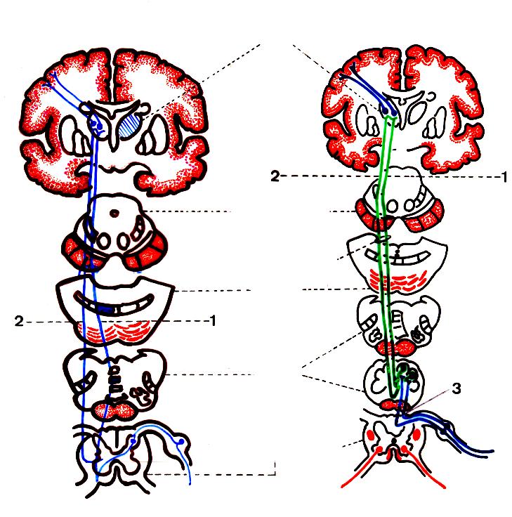 Grandes Sistemas Ascendentes da Medula Espinhal: Antero-lateral e Cordão dorsal-lemnisco Medial. Sistema Antero-lateral Sistema :Cordão Dorsal-Lemnisco Medial. Núcleo Ventral-póstero-lateral N.V.P.L. do Tálamo.