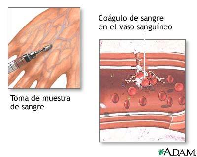 Vitamina B12 (cianocobalamina) e ácido fólico essenciais para síntese de DNA Ácido fólico importante para a manutenção do número e divisão dos macrófagos, com membrana frágil, irregular que vivem por