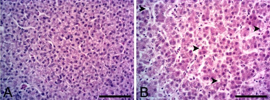 101 Figura 2. Fotomicrografia hepática do grau de esteatose (A - grau 0 e B- grau 1) nas aves com 12 semanas de idade (barra de 100 µm) estudo.