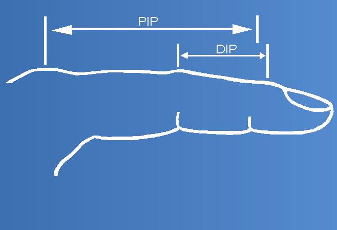 A tensão que a tala exerce consegue fletir uma articulação descontraída até 80º, com uma força de cerca de 2,3 N. INDICAÇÕES contracturas de extensão da articulação IFP.