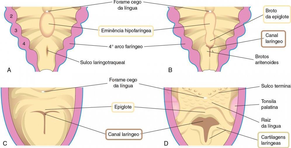 FORMAÇÃO DA LARINGE Orifício laríngeo = fenda sagital = abertura em T = devido à rápida proliferação do mesênquima Epitélio laríngeo = prolifera rapidamente = oclusão