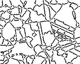 (a) (b) Figura 45. Resultads após a remçã ds pnts múltipls e dilataçã sbre as imagens segmentadas. Sbre a imagem dilatada é realizada a abertura direcinal.