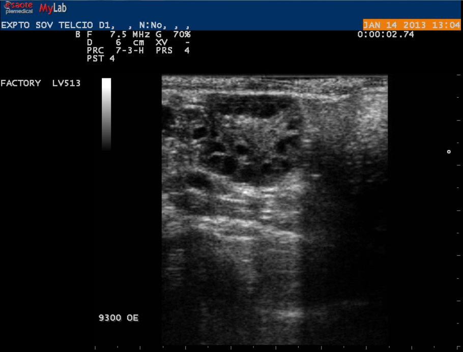 34 FIGURA 2 - Imagem ultrassonográfica do ovário esquerdo do animal 9300 no D1 do tratamento,