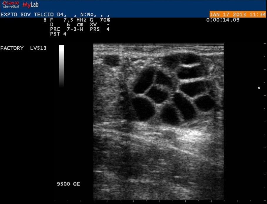FIGURA 3 - Imagem ultrassonográfica do ovário esquerdo do animal 9300 no D4 do tratamento