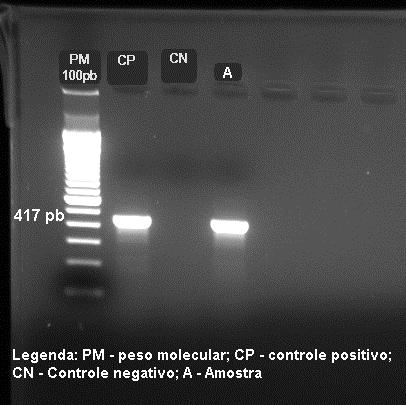 Para a detecção do ácido nucleico viral, foi realizado a PCR.