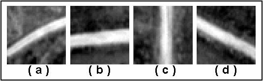 Figura 34 - Erro medindo largura em segmentos inclinados As larguras do segmento nos semi-arcos 1 e 2 têm módulos iguais, entretanto, no semi-arco 3, existe a contribuição de um quinto pixel, como