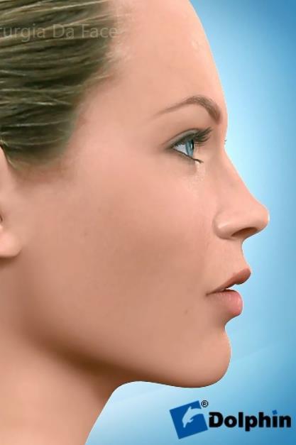 A harmonia entre os diferentes pontos é um importante componente para o equilíbrio facial (Figura 4). Figura 2: Comprimento facial: 1.