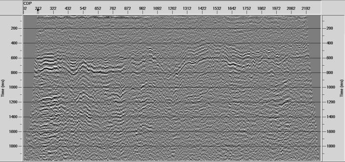 direcional radial (FDR).