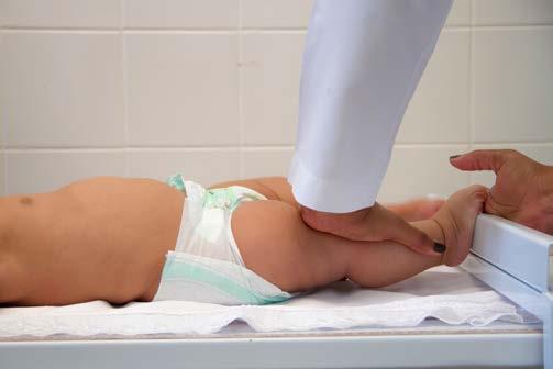 horizontal); os ombros totalmente em contato com a superfície de apoio do infantômetro; os braços estendidos ao longo do corpo.