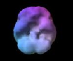 A característica mais comum dos casos típicos de TDAH é a hipofunção do córtex pré-frontal.
