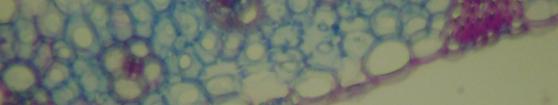 leptostachyus as células buliformes foram observadas apenas na face adaxial, enquanto no A. fissifolius e A.