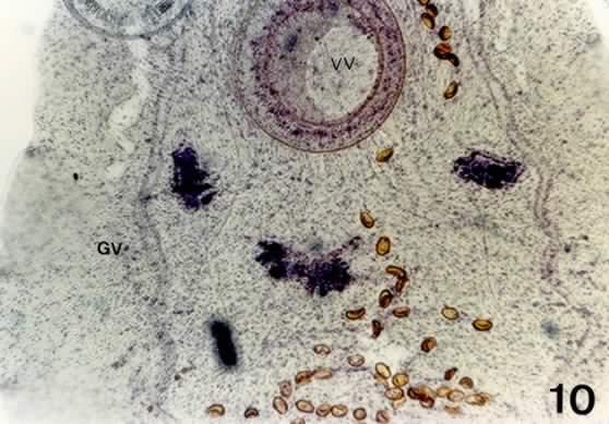 FIGURA 10. Eurytrema coelomaticum recuperado de um caprino experimentalmente infectado com 10 Conocephalus saltator.
