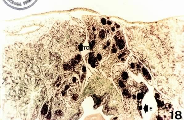 Notar o esporocisto (E) repleto de cercárias (C), a desorganização dos túbulos glandulares (TG) (400 X,