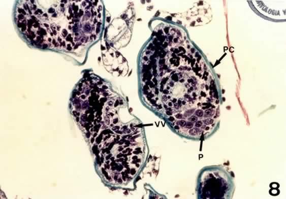 coelomaticum. Parede do cisto (PC) e o parasito (P) (1600 X, Coloração HE). FIGURA 8.  coelomaticum.
