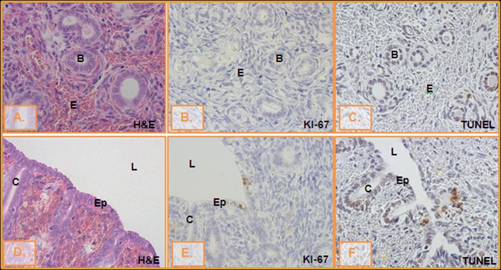 ANESTRO A, B, C GLÂNDULAS BASAIS (400X)