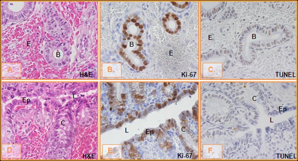 PROESTRO A, B, C GLÂNDULAS BASAIS (400X)