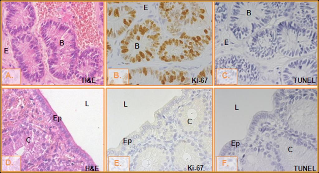 INÍCIO DE DIESTRO (0-10 DIAS) A, B, C GLÂNDULAS