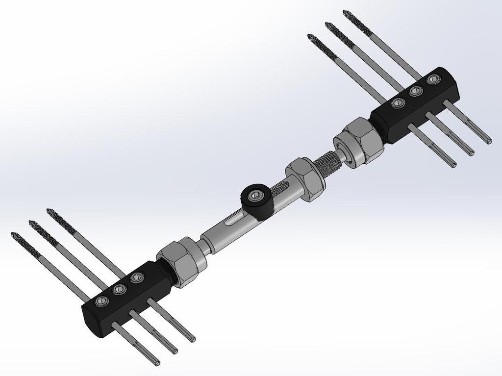 Figura 2: Fixador Externo Dinâmico para Ossos Curtos GDFIX Colles para Punho.