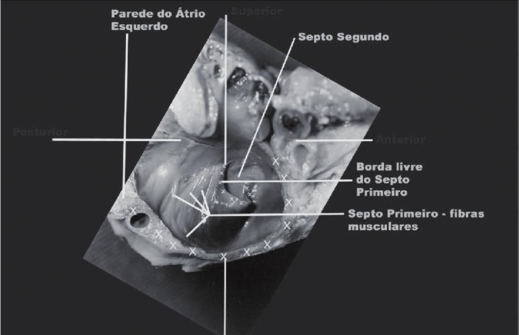 Os cortes macro e microscópicos e suas descrições são observados nas figuras 1 a 7.