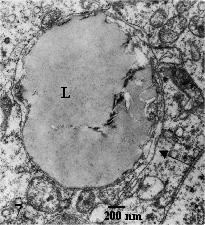 Neste estádio de desenvolvimento, havia prevalência de mitocôndrias alongadas espalhadas por todo o oolema.