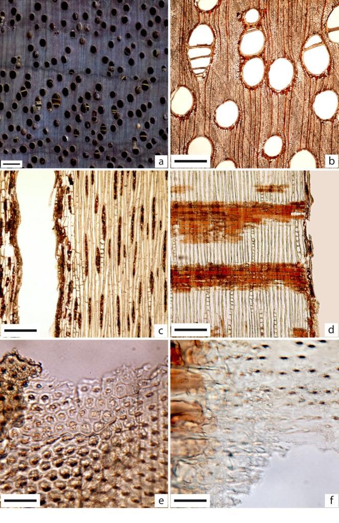 Figura 31 - Cedrelinga cateniformis Em A, imagem macroscópica transversal (Barra=1mm). De B a F imagens microscópicas.