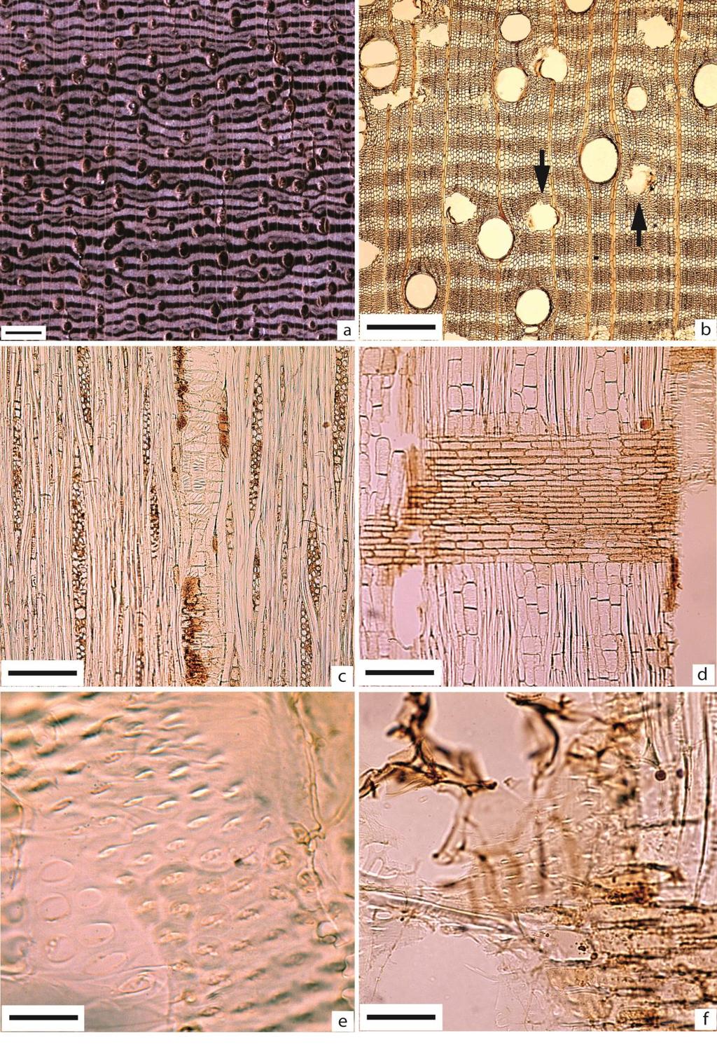 Figura 49 - Erisma uncinatum Em A, imagem macroscópica transversal (Barra=1mm). De B a F imagens microscópicas.