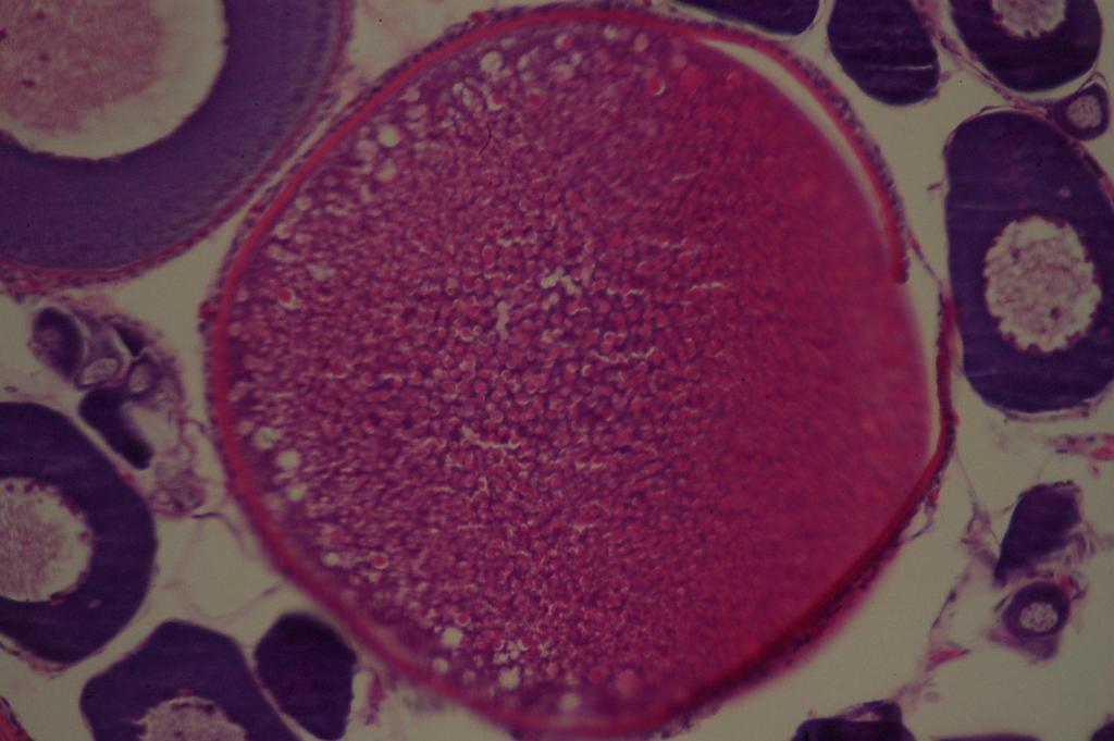 FIGURA 10 Secção transversal de ovário de Leporinus obtusidens. Ovócito IV (seta preta), membrana vitelínea (seta branca), vesículas corticais (seta azul) 40x.
