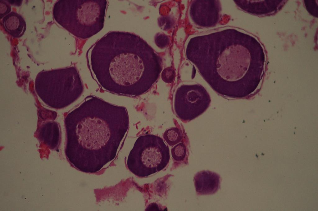 A B C D FIGURA 13 Secções transversais de ovários de Leporinus obtusidens.