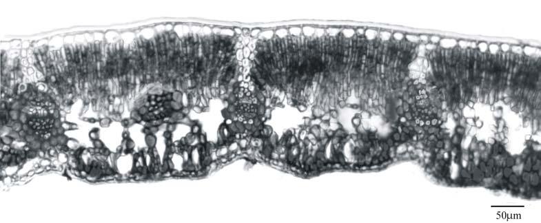 adaxial da epiderme, revelando a forma poligonal das células; (4) Vista frontal da face abaxial da epiderme, mostrando estômatos anomocíticos, sendo