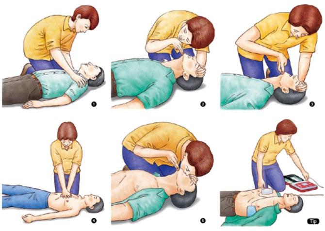 Procedimento de respiração boca a boca e massagem cardíaca. 6.9.2. Massagem cardíaca: Procedimento: Coloque as mãos espalmadas, uma sobre a outra, em cima do peito do indivíduo.