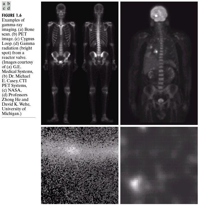 Raios Gama 14 Em PET (Positron Emission Tomography), isótopos radiativos são injetados, e ao decairem, emitem pósitrons que se aniquilam ao encontrar com elétrons e emitem