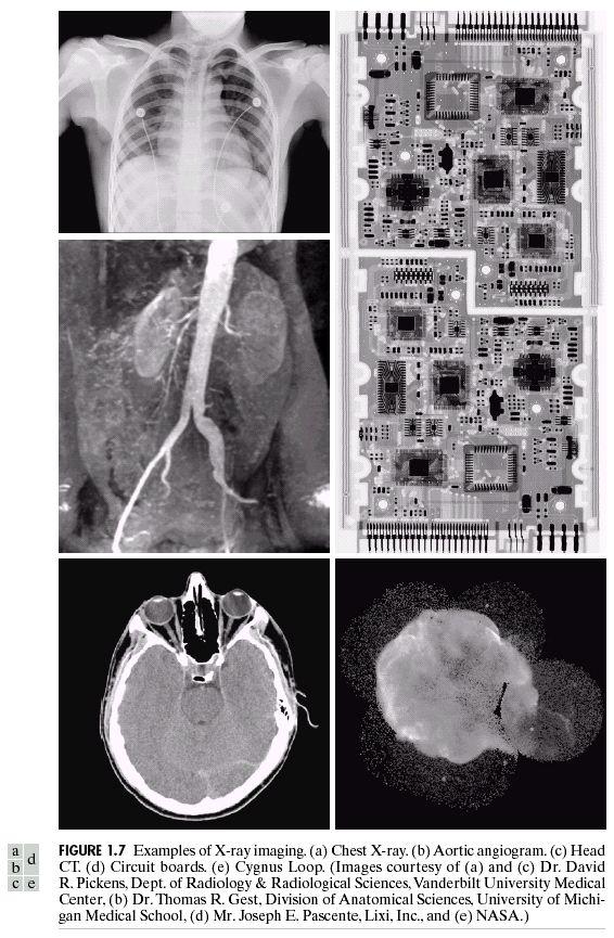 Raios X 17 Descobertos em 1895 por Roentgen No início da década de 70, Hounsfield inventou o CT scan, criando a área da tomografia computadorizada (Nobel de