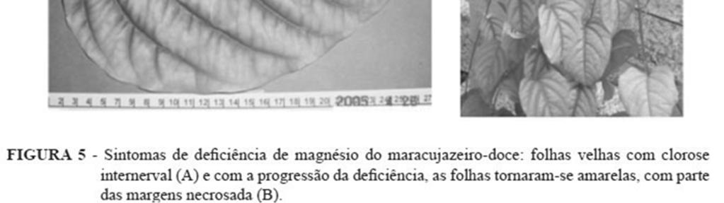 Sintomas da anemia, doença comum em crianças subnutridas e em pessoas com vermes ou que estejam perdendo sangue pelas fezes.