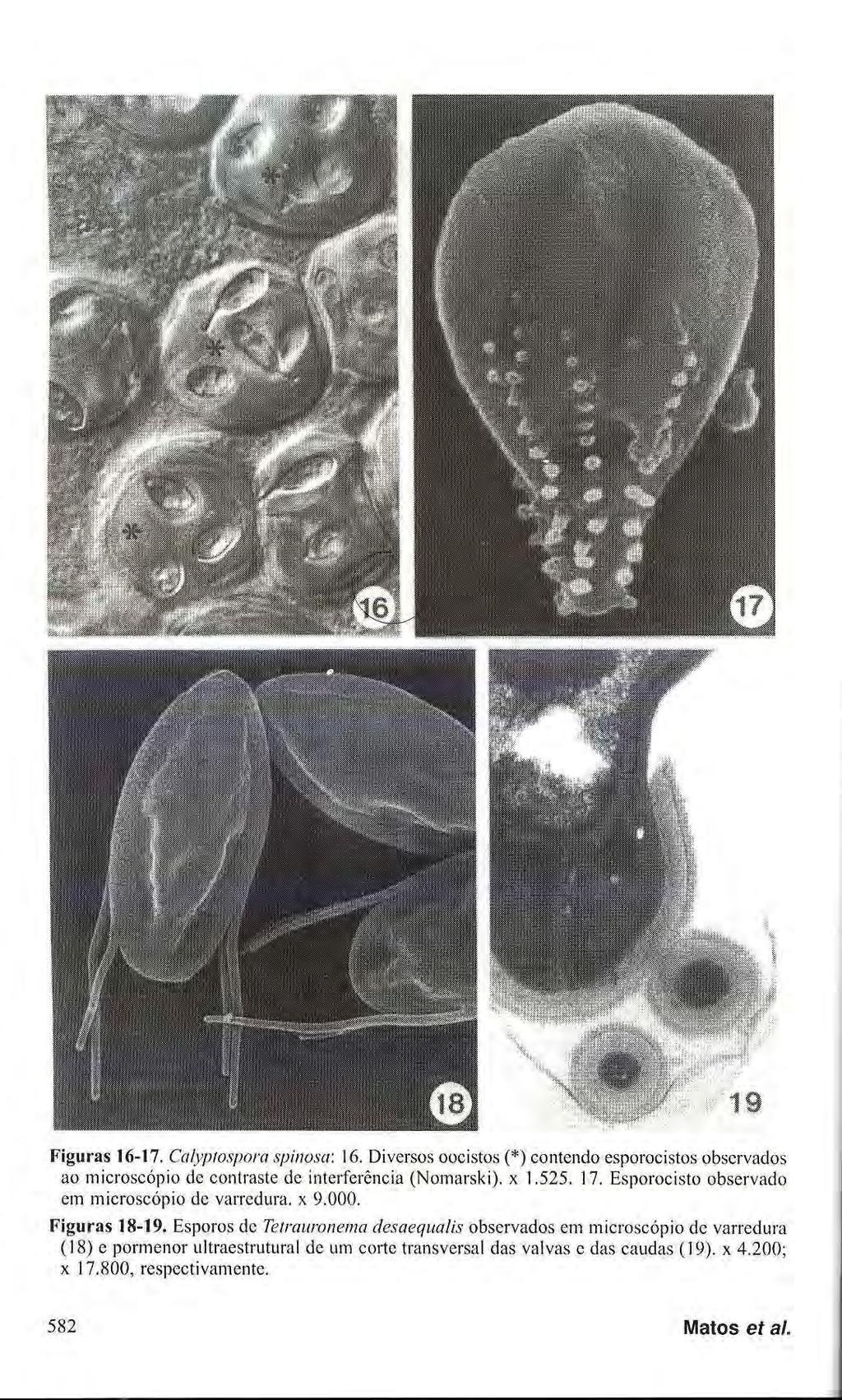 Figuras 16-17. Calyptospora spinosa: 16. Diversos oocistos (*) contendo esporocistos observados ao microscópio de contraste de interferência (Nomarski). χ 1.525. 17.