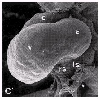 a)nada; b)hipertrofia cardíaca c)cardia bifida (defeito na fusão dos