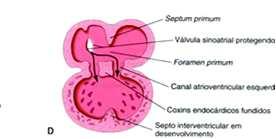 Formação do COXIM ENDOCARDÍACO no coração do coração Visão ventral do coxim endocárdico Visão lateral Visão