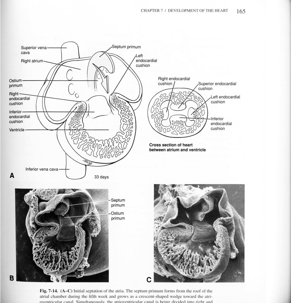 Formação do Septum primum, que se aproxima do coxim cardíaco 2. Aparecimento dos foramen primum e secundum 3.