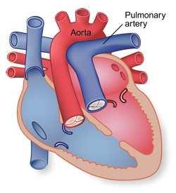 1. Defeito Sept Ventricular http://www.youtube.com/watch?v=yepivalbr4a Mistura de sangue VE e VD 2. Aorta Cavalgada Mistura de sangue VE e VD 3.Estenose da Art. Pulmonar Aumento da Pressão VD 4.