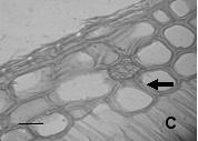 Drusas próximas à cavidade secretora (cs). I. Tricomas tectores. Escalas. C, D. = 5 µm. B, G, H = 50 µm. E, I = 12 µm.