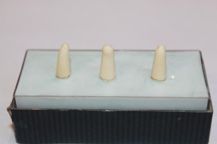 Observação: Parte das coroas dos elementos dentais foi seccionada utilizando uma broca esférica