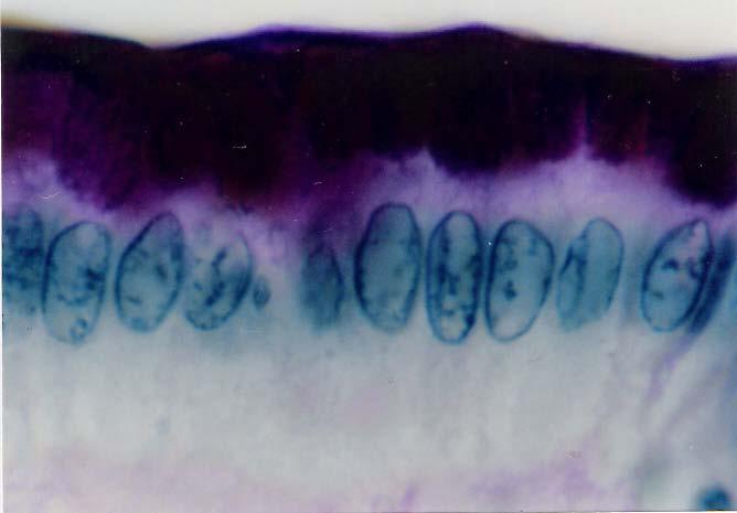 glicoproteínas. O muco secretado é visto sobre a superfície epitelial.