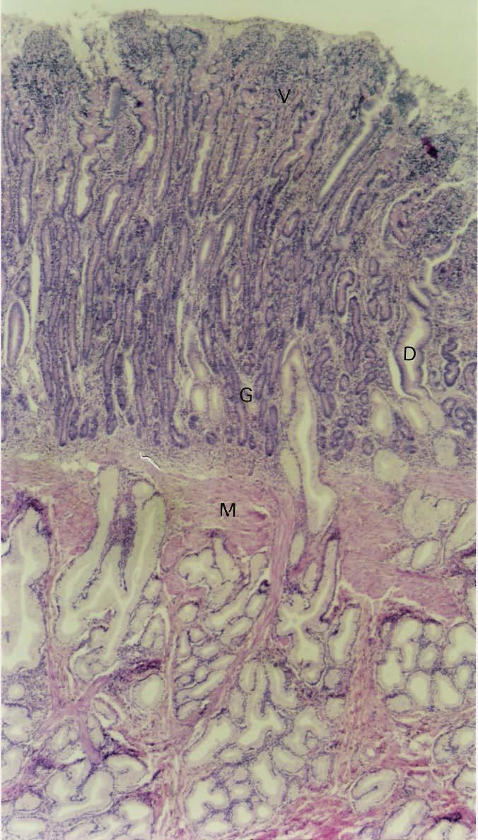 LP Na submucosa do duodeno, há as glândulas duodenais (ou de Brünner), que são glândulas exócrinas tubulares ramificadas mucosas.